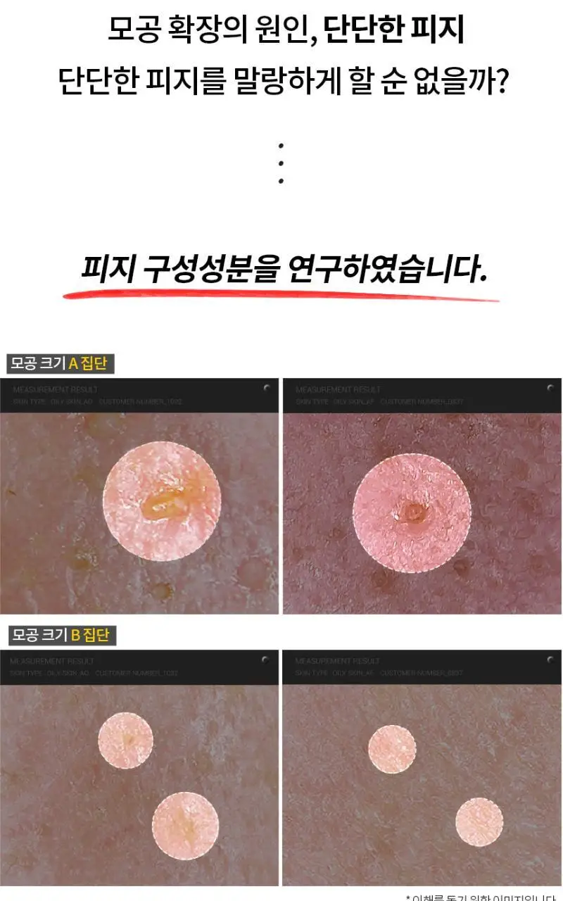 [피지캐는크림] 라돌프 퓨어파지 크림 알엑스 80g 상세페이지 10